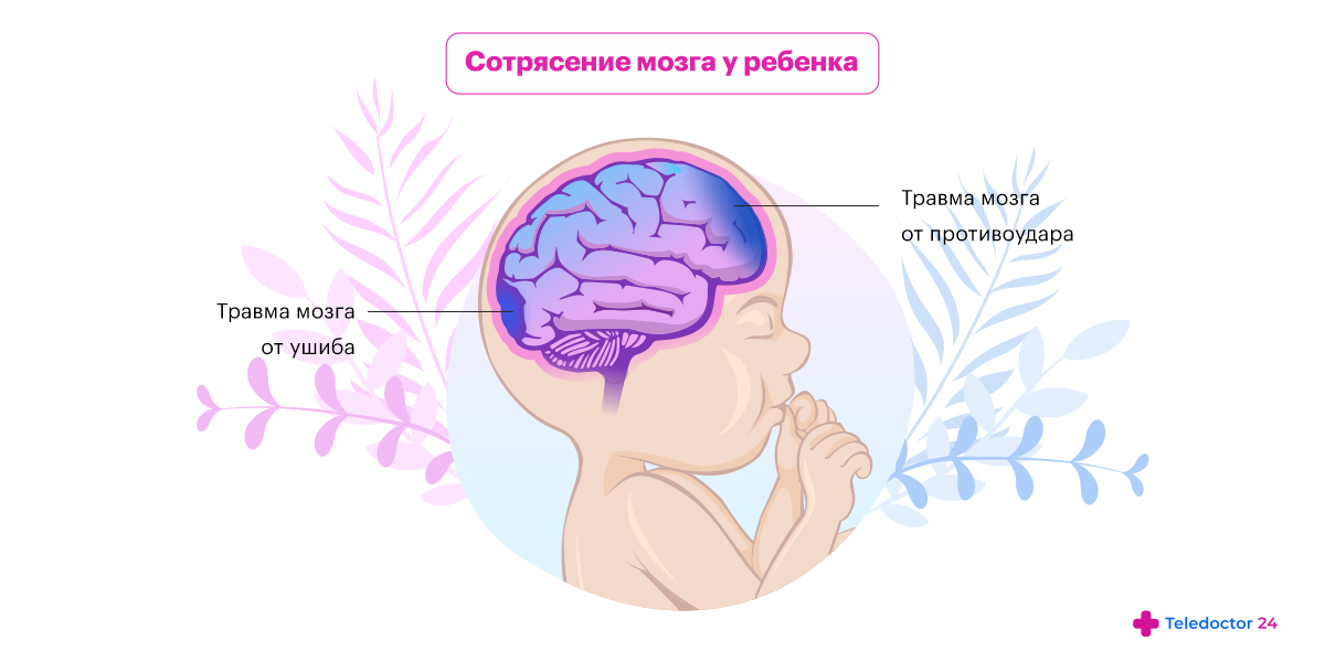 Сотрясение у ребенка лечение. Сотрясение мозга у ребенка. Признаки ушиба мозга у младенца. Синдром детского сотрясения рисунок. Сотрясение у малыша симптомы.