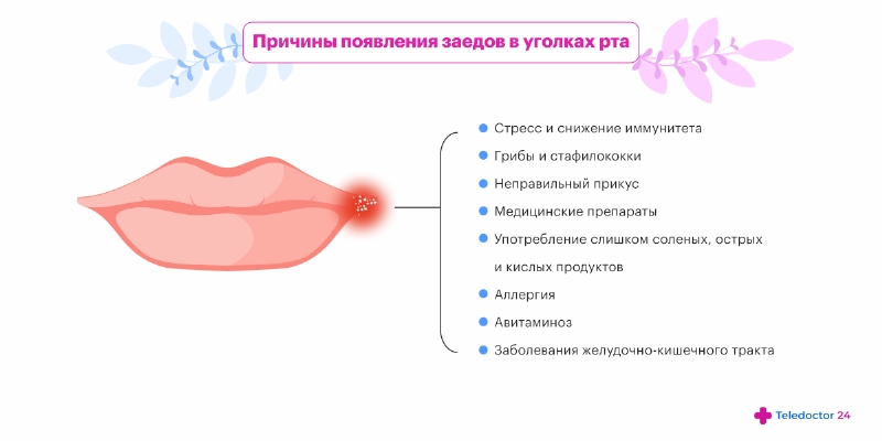 Почему трескаются уголки губ: причины и способы решения проблемы
