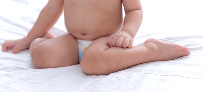 Дисплазия тазобедренных суставов у детей