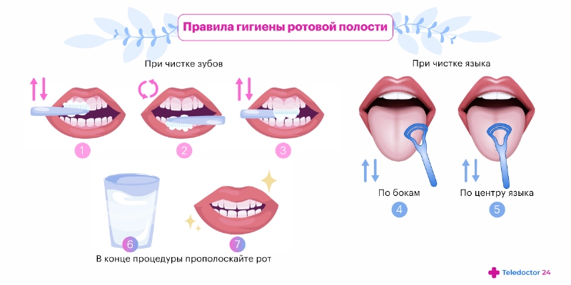 Из-за чего болит язык сбоку - Стоматология - Дента-Ви